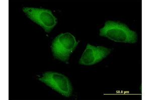 Immunofluorescence of purified MaxPab antibody to PFKP on HeLa cell. (PFKP antibody  (AA 1-784))