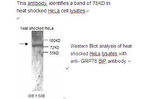 Image no. 1 for anti-Heat Shock 70kDa Protein 5 (Glucose-Regulated Protein, 78kDa) (HSPA5) antibody (ABIN790797) (GRP78 antibody)