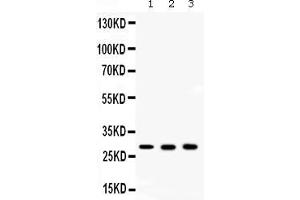 Western blot analysis of CA2 using anti- CA2 antibody . (CA2 antibody  (AA 2-260))