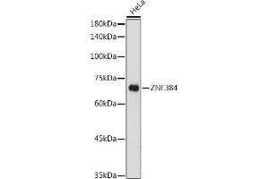 Western blot analysis of extracts of HeLa cells, using ZNF384 antibody (ABIN7271478) at 1:1000 dilution. (ZNF384 antibody  (AA 1-180))