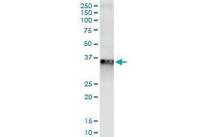 Immunoprecipitation of RLBP1 transfected lysate using anti-RLBP1 MaxPab rabbit polyclonal antibody and Protein A Magnetic Bead , and immunoblotted with RLBP1 purified MaxPab mouse polyclonal antibody (B01P) . (RLBP1 antibody  (AA 1-317))