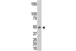 Western Blotting (WB) image for anti-Creatine Kinase, Muscle (CKM) antibody (ABIN3002974) (CKM antibody)