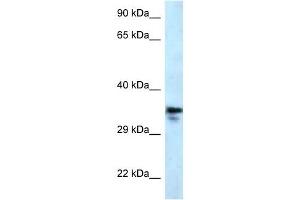 Western Blot showing MMACHC antibody used at a concentration of 1 ug/ml against U937 Cell Lysate (MMACHC antibody  (C-Term))
