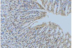 ABIN6277248 at 1/100 staining Human gastric tissue by IHC-P.