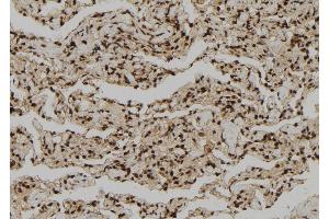 ABIN6272311 at 1/100 staining Human lung tissue by IHC-P. (GZMH antibody)
