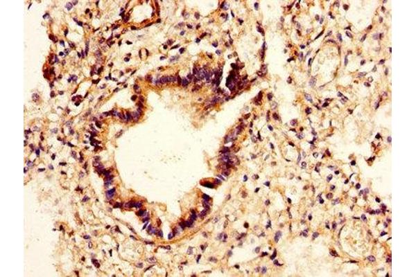 CHI3L2 antibody  (AA 27-390)