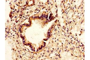 IHC image of ABIN7147557 diluted at 1:400 and staining in paraffin-embedded human lung tissue performed on a Leica BondTM system. (CHI3L2 antibody  (AA 27-390))