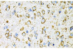 Immunohistochemistry of paraffin-embedded Rat brain using LRPAP1 Polyclonal Antibody at dilution of 1:200 (40x lens).