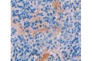 Used in DAB staining on fromalin fixed paraffin- embedded Kidney tissue (CBL antibody  (AA 558-816))