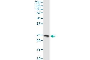RRAS MaxPab rabbit polyclonal antibody. (R-Ras antibody  (AA 1-218))