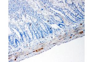 Anti-PC1/3 antibody, IHC(P) IHC(P): Rat Intestine Tissue (PCSK1 antibody  (C-Term))
