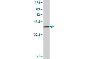 Western Blot detection against Immunogen (36. (LIPA3 antibody  (AA 1043-1139))