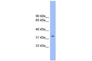 WB Suggested Anti-SLC25A1 Antibody Titration:  0. (Slc25a1 antibody  (Middle Region))