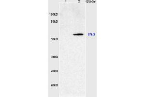 L1 rat intestine lysates L2 rat brain lysates probed with Anti SOAT2/ACAT2 Polyclonal Antibody, Unconjugated (ABIN708476) at 1:200 overnight at 4 °C. (SOAT2 antibody  (AA 331-430))