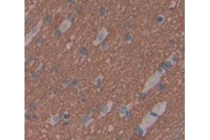 IHC-P analysis of Human Tissue, with DAB staining. (TWSG1 antibody  (AA 26-223))