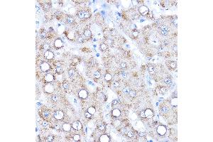Immunohistochemistry of paraffin-embedded human liver using AADAT Rabbit pAb (ABIN6127318, ABIN6136315, ABIN6136317 and ABIN6216952) at dilution of 1:200 (40x lens). (AADAT antibody  (AA 34-429))