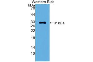 Western blot analysis of the recombinant protein. (GATA1 antibody  (AA 42-292))