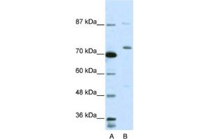 Western Blotting (WB) image for anti-Exosome Component 10 (EXOSC10) antibody (ABIN2462060) (EXOSC10 antibody)
