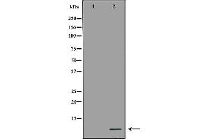 Western blot analysis of Hela cell lysate, using MT2A Antibody. (MT2A antibody)