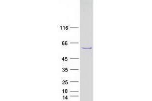 Validation with Western Blot (TBL1Y Protein (Transcript Variant 1) (Myc-DYKDDDDK Tag))