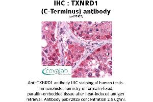 Image no. 2 for anti-Thioredoxin Reductase 1 (TXNRD1) (C-Term) antibody (ABIN1740489) (TXNRD1 antibody  (C-Term))