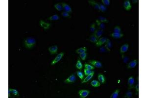 Immunofluorescent analysis of HepG2 cells using ABIN7152974 at dilution of 1:100 and Alexa Fluor 488-congugated AffiniPure Goat Anti-Rabbit IgG(H+L) (FPR1 antibody  (AA 306-350))
