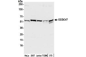 anti-Coiled-Coil Domain Containing 47 (CCDC47) (AA 433-483) antibody