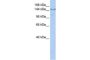 UGCGL2 antibody used at 1 ug/ml to detect target protein. (UGCGL2 antibody  (N-Term))
