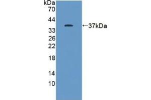 Western blot analysis of recombinant Human KEAP1. (KEAP1 antibody  (AA 327-624))