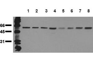 Western Blotting (WB) image for anti-Beclin 1, Autophagy Related (BECN1) antibody (ABIN492611) (Beclin 1 antibody)