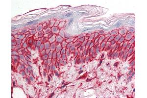 Anti-CD44 antibody IHC staining of human skin. (CD44 antibody)