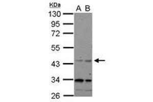 Image no. 1 for anti-CHRNA7 (Cholinergic Receptor, Nicotinic, alpha 7, Exons 5-10) and FAM7A (Family with Sequence Similarity 7A, Exons A-E) Fusion (CHRFAM7A) (AA 1-177) antibody (ABIN1497505) (CHRFAM7A antibody  (AA 1-177))
