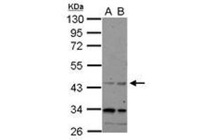 Image no. 1 for anti-CHRNA7 (Cholinergic Receptor, Nicotinic, alpha 7, Exons 5-10) and FAM7A (Family with Sequence Similarity 7A, Exons A-E) Fusion (CHRFAM7A) (AA 1-177) antibody (ABIN1497505) (CHRFAM7A antibody  (AA 1-177))