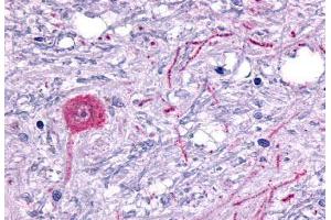 Anti-HTR6 / 5-HT6 antibody  ABIN1048968 IHC staining of human brain, neuron. (Serotonin Receptor 6 antibody  (C-Term))