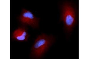 Immunofluorescence (IF) image for anti-Cystatin SN (CST1) (AA 21-141) antibody (APC) (ABIN5568436) (CST1 antibody  (AA 21-141) (APC))