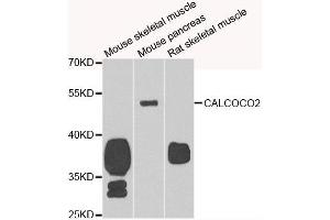 Western blot analysis of extracts of various cell lines, using CALCOCO2 antibody. (CALCOCO2 antibody)