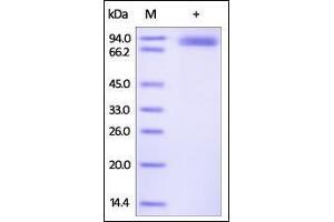 Human ROR2, Fc Tag on SDS-PAGE under reducing (R) condition. (ROR2 Protein (AA 34-403) (Fc Tag))