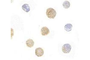 Immunocytochemistry of ADAP in K562 cells with AP30019PU-N ADAP antibody at 10 μg/ml. (FYB antibody  (C-Term))