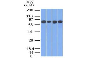 Western Blot of HT20, A549, 293 and A431 cell lysates using C Catenin, gamma Mouse Monoclonal Antibody (11E4). (JUP antibody)