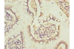 Immunohistochemistry of paraffin-embedded human small intestine tissue using ABIN7172381 at dilution of 1:100 (DHDH antibody  (AA 1-334))