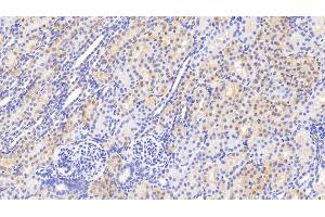 Detection of GSS in Human Kidney Tissue using Polyclonal Antibody to Glutathione Synthetase (GSS) (Glutathione Synthetase antibody  (AA 268-474))