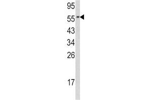 Western Blotting (WB) image for anti-Cell Division Cycle 23 (CDC23) antibody (ABIN3002712) (CDC23 antibody)