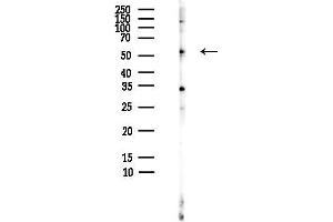 anti-Gardner-Rasheed Feline Sarcoma Viral (V-Fgr) Oncogene Homolog (FGR) (Internal Region) antibody