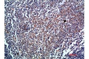 Immunohistochemical analysis of paraffin-embedded human-tonsil, antibody was diluted at 1:200