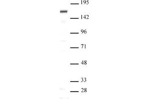 SIP1 antibody (pAb) tested by Western blot Nuclear extract of Saos-2 cells (20 μg per lane) probed with SIP1 antibody (pAb) at a dilution of 1:500. (SIP1 antibody  (N-Term))