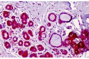Human Breast: Formalin-Fixed, Paraffin-Embedded (FFPE) (RREB1 antibody  (AA 560-609))