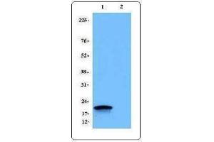 Western Blotting (WB) image for anti-CD247 Molecule (CD247) antibody (ABIN2664433) (CD247 antibody)