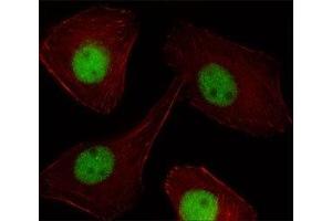 Fluorescent image of U251 cell stained with PR antibody at 1:25. (Progesterone Receptor antibody  (AA 816-843))