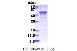 SDS-PAGE (SDS) image for BRISC and BRCA1 A Complex Member 1 (BABAM1) (AA 1-329) protein (His tag) (ABIN5853835) (BRISC and BRCA1 A Complex Member 1 (BABAM1) (AA 1-329) protein (His tag))