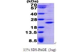 SDS-PAGE (SDS) image for Pleckstrin Homology-Like Domain, Family A, Member 2 (PHLDA2) (AA 1-152) protein (His tag) (ABIN7529145) (PHLDA2 Protein (AA 1-152) (His tag))